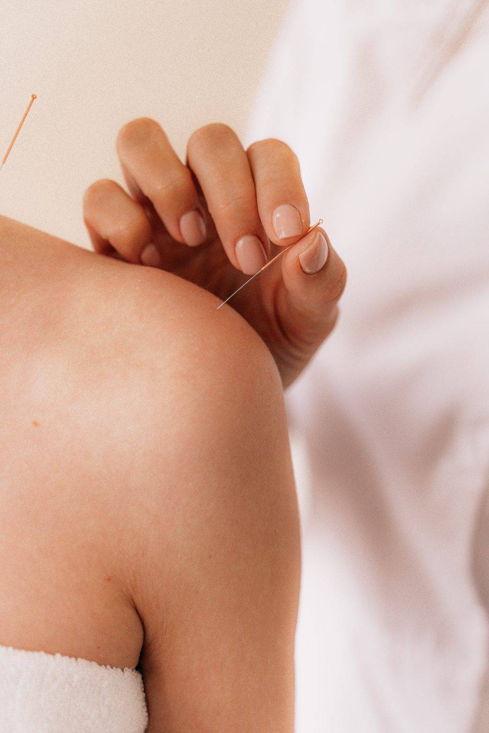 Mains de l'acupunctrice insérant une fine aiguille dans l'épaule d'une patiente